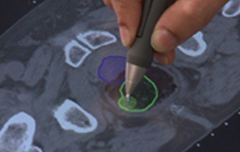 real time treatment planning