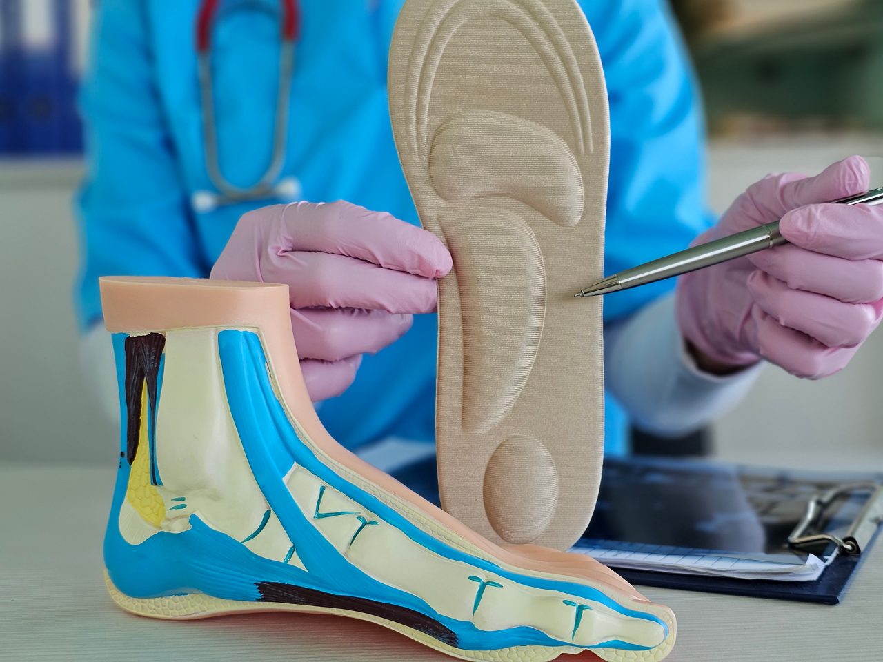 Foot anatomy model illustrated by a healthcare professional during a consultation about podiatric care and orthotics