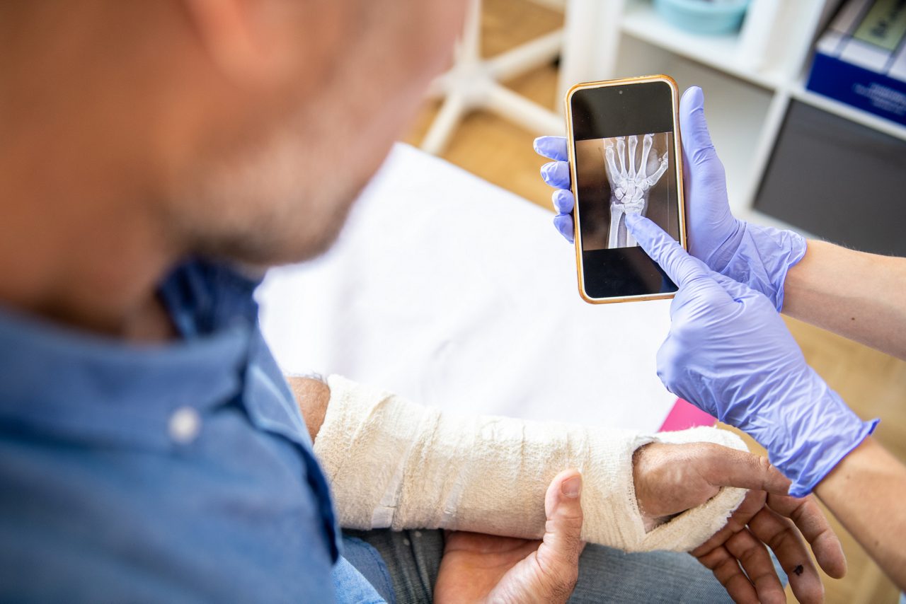Male patient with a broken arm bones being examined by an woman orthopedic specialist, hand and smart phone screen close up.