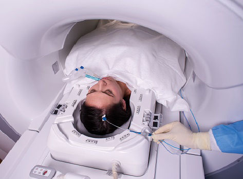 A patient receives LITT therapy in lieu of invasive surgery for recurrent brain tumors.