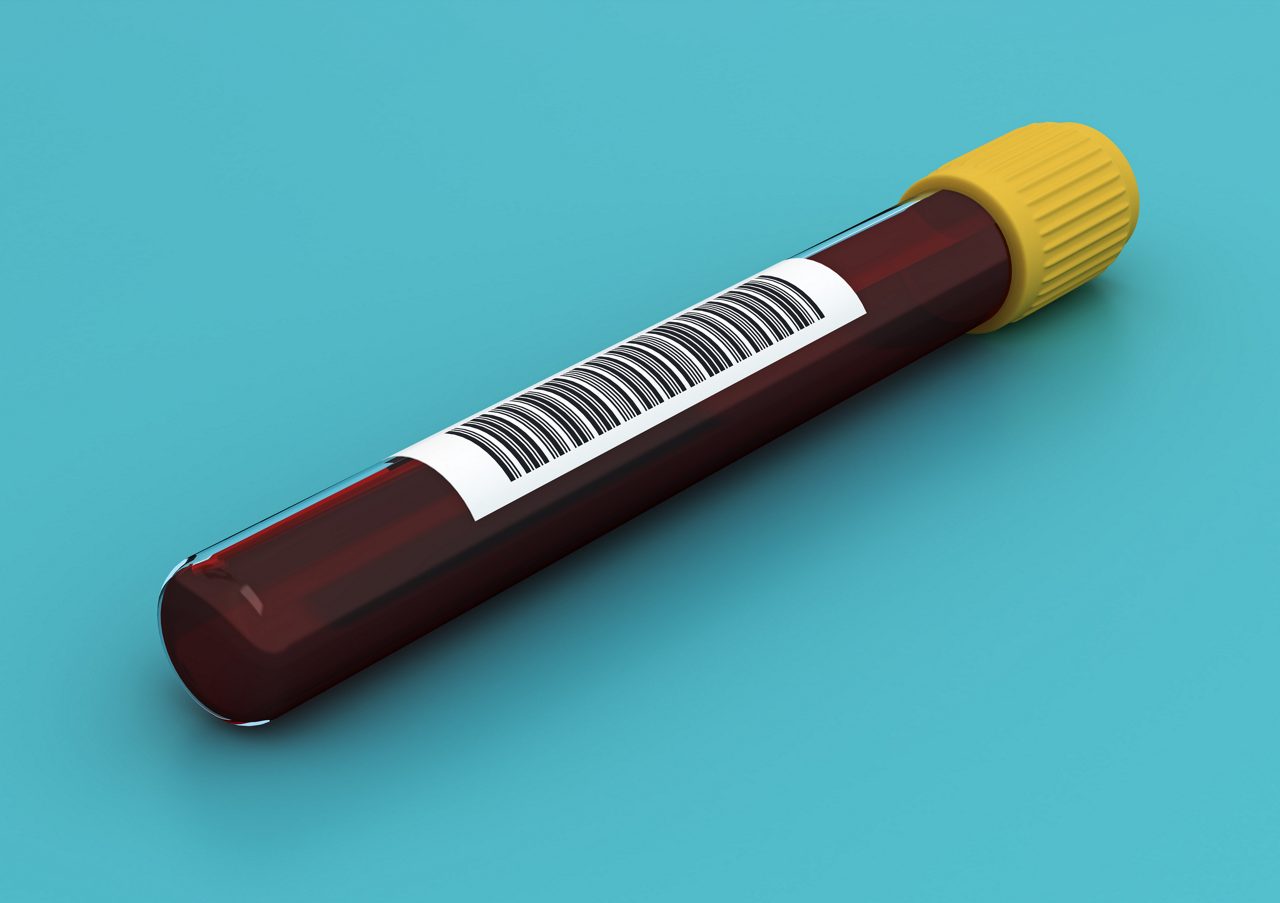 Blood sample tube.