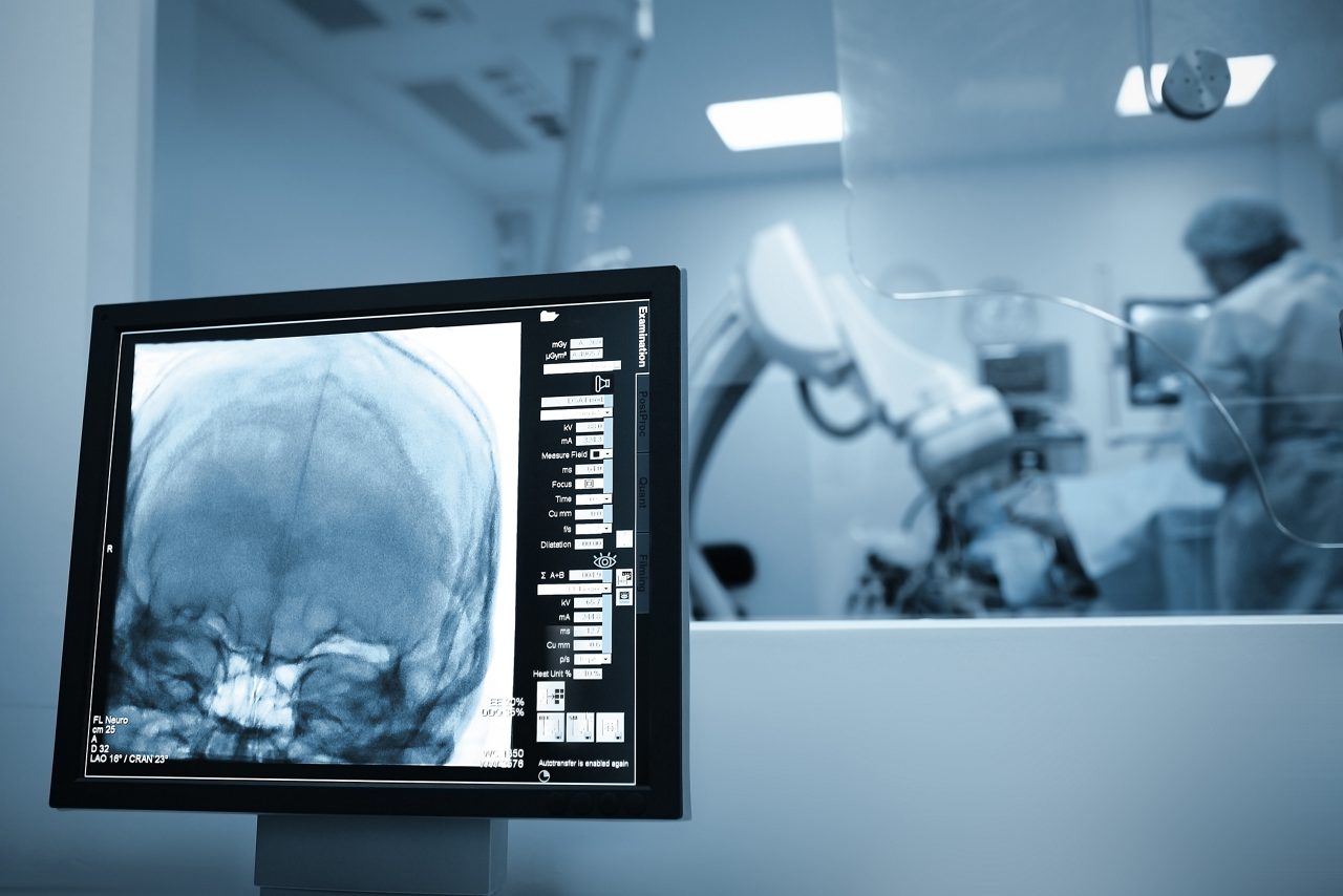 X-ray scan of the patients brain during surgery.