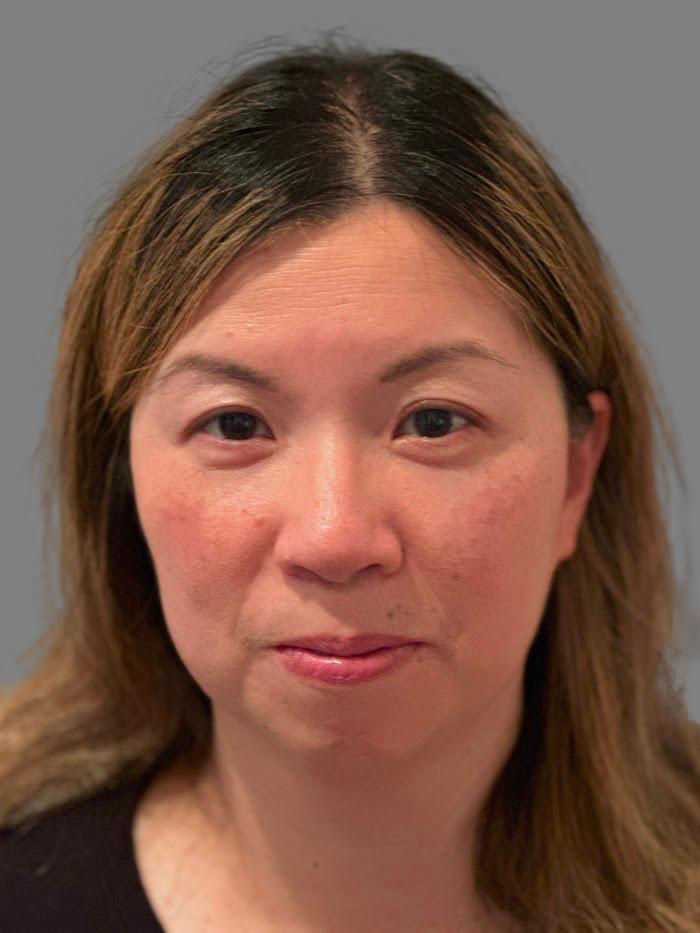 Susie Chen,  MD