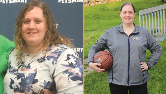 Mary before and after bariatric surgery.
