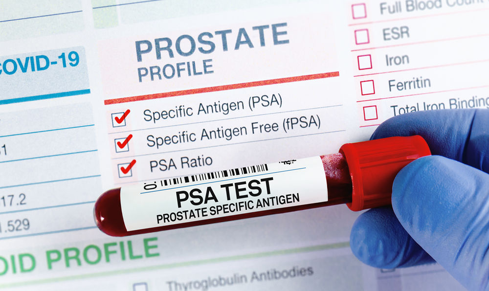 Prostate cancer